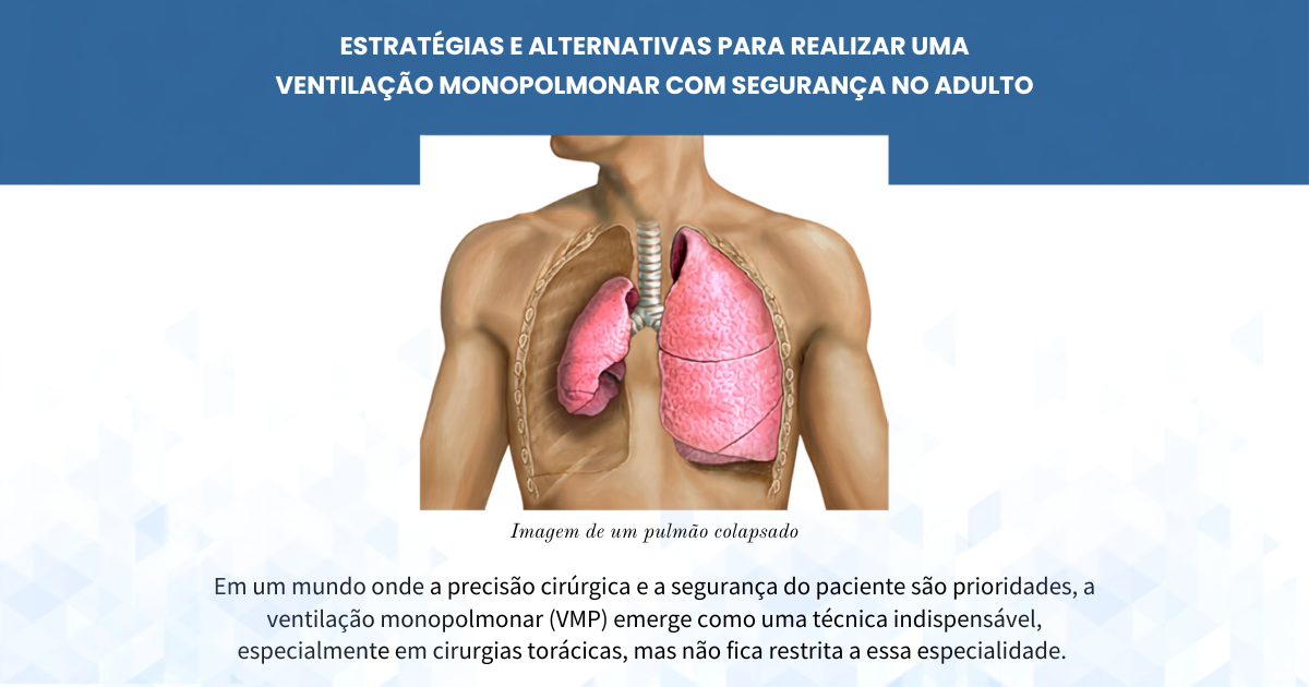 Estratégias e alternativas para realizar uma ventilação monopulmonar com segurança no adulto